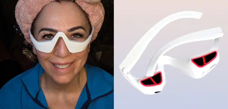 Renewa Eyelift Device (Official Retailer) 2025